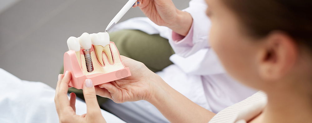 Are Dental Implants Covered By Insurance?