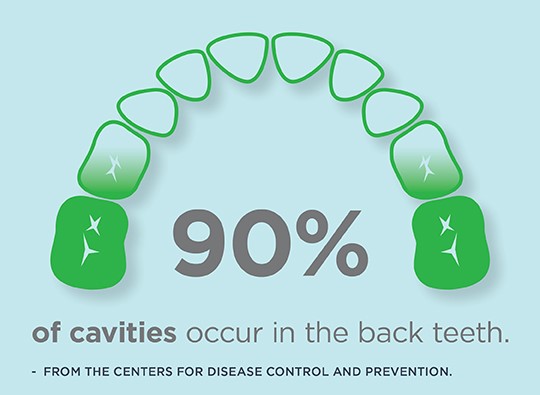 Graphic of the bottom jaw and teeth, with text saying 90 percent of cavities occur in the back teeth and a citation from the Centers for Disease Control and Prevention.