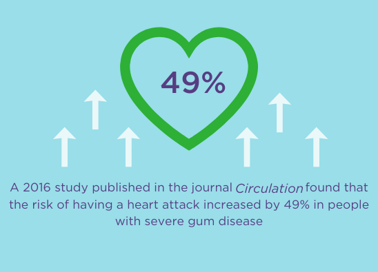 A 2016 study published in Circulation journal found that the risk of having a heart attack increased by 49% in people with severe gum disease.
