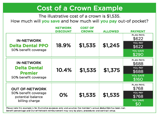 Delta dental wa cost of crown example