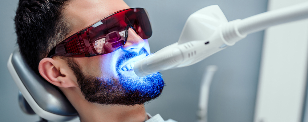 Teeth Whitening Tips For Every Smile Delta Dental Of Washington